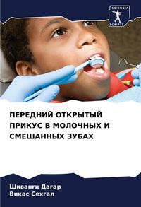Produktbild: Perednij Otkrytyj Prikus V Molochnyh I Smeshannyh Zubah