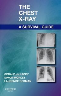Produktbild: The Chest X-Ray: A Survival Guide