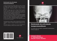 Produktbild: Desloca&ccedil;&atilde;o da articula&ccedil;&atilde;o temporomandibular