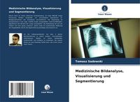 Produktbild: Medizinische Bildanalyse, Visualisierung und Segmentierung
