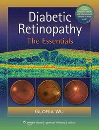 Produktbild: Wu, G: Diabetic Retinopathy