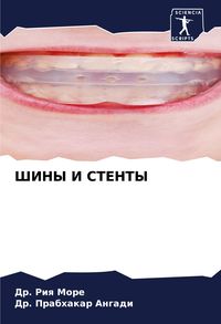 Produktbild: ShINY I STENTY