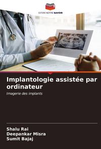 Produktbild: Implantologie assist&eacute;e par ordinateur