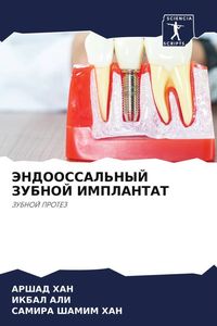 Produktbild: Jendoossal'nyj Zubnoj Implantat