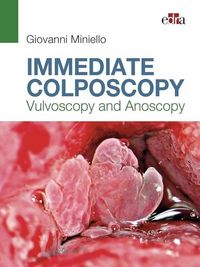 Produktbild: Immediate Colposcopy - Vulvoscopy and Anoscopy