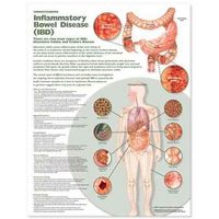 Produktbild: Understanding Inflammatory Bow
