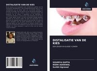 Produktbild: Distalisatie Van De Kies