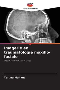 Produktbild: Imagerie en traumatologie maxillo-faciale