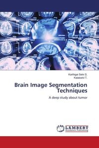 Produktbild: Brain Image Segmentation Techniques