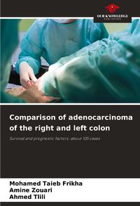 Produktbild: Comparison of adenocarcinoma of the right and left colon