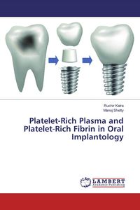 Produktbild: Platelet-Rich Plasma and Platelet-Rich Fibrin in Oral Implantology