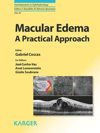 Produktbild: Macular Edema