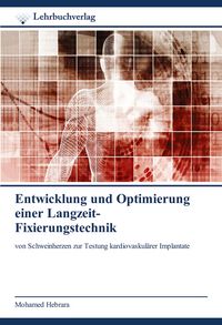 Produktbild: Entwicklung und Optimierung einer Langzeit- Fixierungstechnik