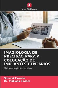 Produktbild: Imagiologia De Precis&atilde;o Para a Coloca&ccedil;&atilde;o De Implantes Dent&aacute;rios