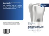 Produktbild: Assessment of Apical Root Resorption during Anterior Retraction