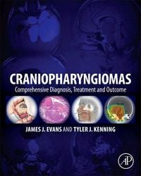 Produktbild: Craniopharyngiomas