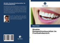 Produktbild: Direkte Kompositrestauration im Frontzahnbereich