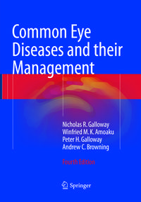 Produktbild: Common Eye Diseases and their Management