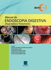 Produktbild: Manual de endoscopia digestiva - SOBED/RS