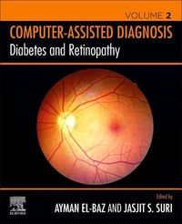 Produktbild: Diabetes and Retinopathy