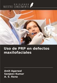 Produktbild: Uso de PRP en defectos maxilofaciales