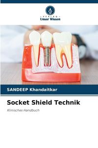 Produktbild: Socket Shield Technik