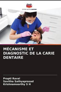 Produktbild: M&eacute;canisme Et Diagnostic De La Carie Dentaire