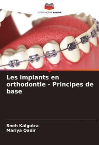 Produktbild: Les implants en orthodontie - Principes de base