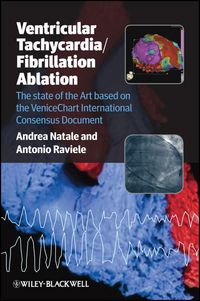 Produktbild: Ventricular Tachycardia / Fibrillation Ablation