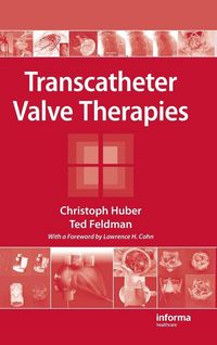 Produktbild: Transcatheter Valve Therapies