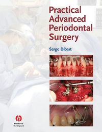 Produktbild: Prac Advd Periodontal Surgery
