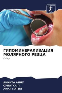 Produktbild: Gipomineralizaciya Molyarnogo Rezca