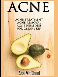 Produktbild: Acne