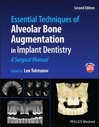 Produktbild: Essential Techniques of Alveolar Bone Augmentation in Implant Dentistry
