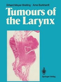 Produktbild: Tumours of the Larynx