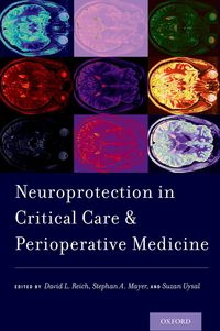 Produktbild: Neuroprotection in Critical Care and Perioperative Medicine