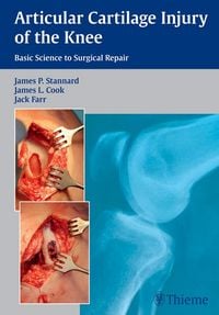 Produktbild: Articular Cartilage Injury of the Knee: Basic Science to Surgical Repair