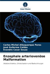 Produktbild: Enzephale arterioven&ouml;se Malformation