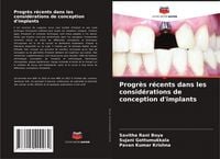Produktbild: Progr&egrave;s r&eacute;cents dans les consid&eacute;rations de conception d'implants