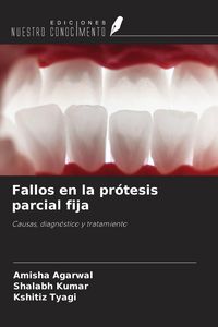 Produktbild: Fallos en la pr&oacute;tesis parcial fija
