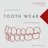 Produktbild: Tooth Wear