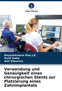 Produktbild: Verwendung und Genauigkeit eines chirurgischen Stents zur Platzierung eines Zahnimplantats
