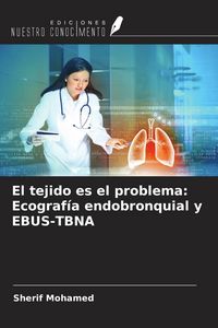 Produktbild: El tejido es el problema: Ecograf&iacute;a endobronquial y EBUS-TBNA