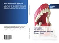 Produktbild: Cement Selection in Luting Implant Crown