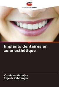 Produktbild: Implants dentaires en zone esth&eacute;tique