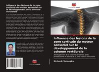 Produktbild: Influence des l&eacute;sions de la zone corticale du moteur sensoriel sur le d&eacute;veloppement de la colonne vert&eacute;brale