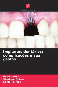 Produktbild: Implantes dent&aacute;rios: complica&ccedil;&otilde;es e sua gest&atilde;o