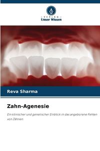 Produktbild: Zahn-Agenesie