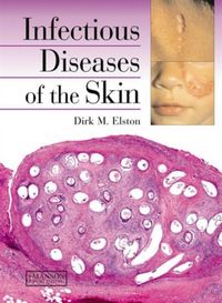 Produktbild: INFECTIOUS DISEASES OF THE SKI