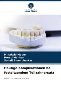 Produktbild: H&auml;ufige Komplikationen bei festsitzendem Teilzahnersatz
